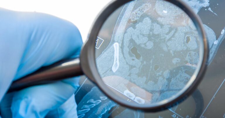 A medical professional uses a magnifying glass to look at an x-ray of the digestive system.